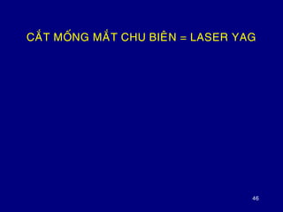 46
CAÉT MOÁNG MAÉT CHU BIEÂN = LASER YAG
 
