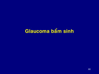 80
Glaucoma baåm sinh
 