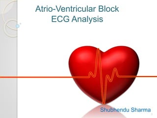 Atrio-Ventricular Block
ECG Analysis
Shubhendu Sharma
1
 