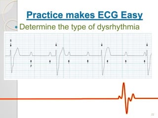 Practice makes ECG Easy
 Determine the type of dysrhythmia
22
 