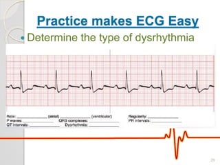 Practice makes ECG Easy
 Determine the type of dysrhythmia
29
 