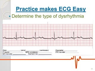 Practice makes ECG Easy
 Determine the type of dysrhythmia
30
 