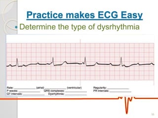 Practice makes ECG Easy
 Determine the type of dysrhythmia
35
 