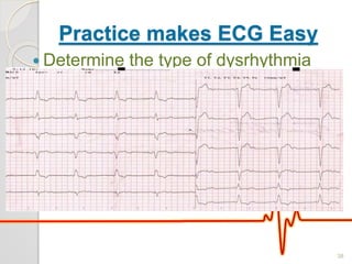 Practice makes ECG Easy
 Determine the type of dysrhythmia
38
 