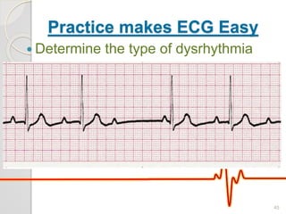 Practice makes ECG Easy
 Determine the type of dysrhythmia
45
 