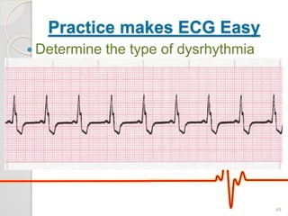 Practice makes ECG Easy
 Determine the type of dysrhythmia
48
 