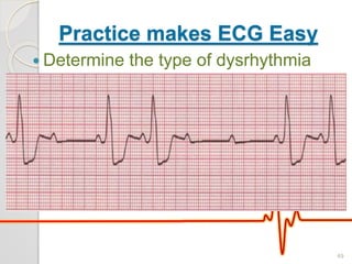 Practice makes ECG Easy
 Determine the type of dysrhythmia
49
 