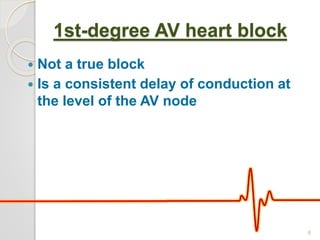 1st-degree AV heart block
 Not a true block
 Is a consistent delay of conduction at
the level of the AV node
6
 