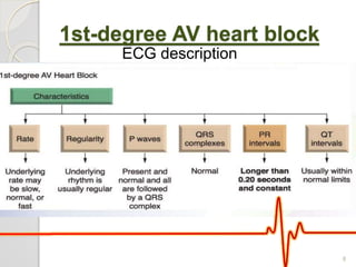 1st-degree AV heart block
ECG description
8
 