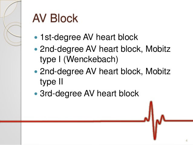 Av Block Ecg Analysis