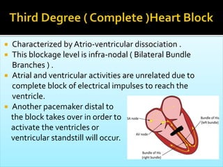  Characterized by Atrio-ventricular dissociation .
 This blockage level is infra-nodal ( Bilateral Bundle
Branches ) .
 Atrial and ventricular activities are unrelated due to
complete block of electrical impulses to reach the
ventricle.
 Another pacemaker distal to
the block takes over in order to
activate the ventricles or
ventricular standstill will occur.
 