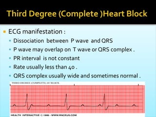  ECG manifestation :
 Dissociation between P wave and QRS
 P wave may overlap on T wave or QRS complex .
 PR interval is not constant
 Rate usually less than 40 .
 QRS complex usually wide and sometimes normal .
 