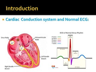  Cardiac Conduction system and Normal ECG:
 