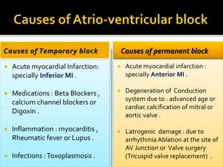  Acute myocardial Infarction:
specially Inferior MI .
 Medications : Beta Blockers ,
calcium channel blockers or
Digoxin .
 Inflammation : myocarditis ,
Rheumatic fever or Lupus .
 Infections :Toxoplasmosis .
Causes of permanent block
 Acute myocardial infarction :
specially Anterior MI .
 Degeneration of Conduction
system due to : advanced age or
cardiac calcification of mitral or
aortic valve .
 Latrogenic damage : due to
arrhythmia Ablation at the site of
AV Junction or Valve surgery
(Tricuspid valve replacement) .
 
