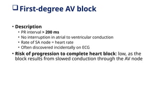 First-degree AV block
• Description
• PR interval > 200 ms
• No interruption in atrial to ventricular conduction
• Rate of SA node = heart rate
• Often discovered incidentally on ECG
• Risk of progression to complete heart block: low, as the
block results from slowed conduction through the AV node
 