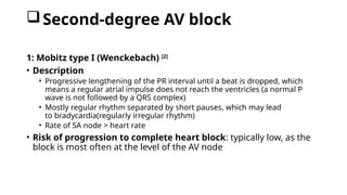 Second-degree AV block
1: Mobitz type I (Wenckebach) [2]
• Description
• Progressive lengthening of the PR interval until a beat is dropped, which
means a regular atrial impulse does not reach the ventricles (a normal P
wave is not followed by a QRS complex)
• Mostly regular rhythm separated by short pauses, which may lead
to bradycardia(regularly irregular rhythm)
• Rate of SA node > heart rate
• Risk of progression to complete heart block: typically low, as the
block is most often at the level of the AV node
 