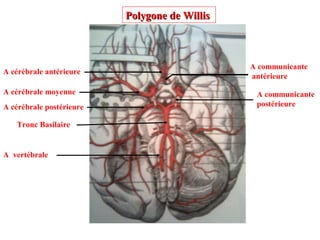 A vertébrale
Tronc Basilaire
A cérébrale antérieure
A communicante
antérieure
A cérébrale moyenne A communicante
postérieureA cérébrale postérieure
Polygone de WillisPolygone de Willis
 