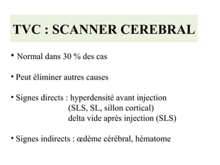 TVC : SCANNER CEREBRAL
• Normal dans 30 % des cas
• Peut éliminer autres causes
• Signes directs : hyperdensité avant injection
(SLS, SL, sillon cortical)
delta vide après injection (SLS)
• Signes indirects : œdème cérébral, hématome
 