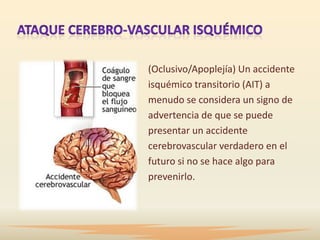 (Oclusivo/Apoplejía) Un accidente
isquémico transitorio (AIT) a
menudo se considera un signo de
advertencia de que se puede
presentar un accidente
cerebrovascular verdadero en el
futuro si no se hace algo para
prevenirlo.
 