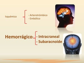 Isquémico   - Arterotrómbico
            - Embólico




Hemorrágico: - Intracraneal
                  - Subaracnoide
 