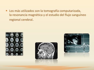  Los más utilizados son la tomografía computarizada,
  la resonancia magnética y el estudio del flujo sanguíneo
  regional cerebral.
 