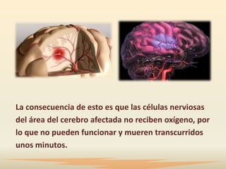 La consecuencia de esto es que las células nerviosas
del área del cerebro afectada no reciben oxígeno, por
lo que no pueden funcionar y mueren transcurridos
unos minutos.
 