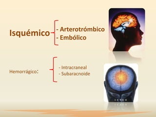 - Arterotrómbico
Isquémico      - Embólico



               - Intracraneal
Hemorrágico:   - Subaracnoide
 