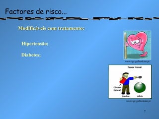 Factores de risco... Modificáveis com tratamento: www.igc.gulbenkian.pt www.igc.gulbenkian.pt Hipertensão; Diabetes; 