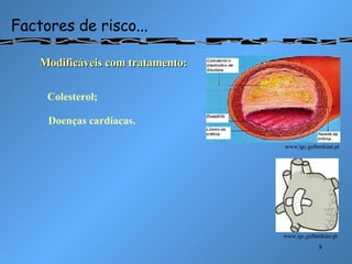 Factores de risco... Modificáveis com tratamento: www.igc.gulbenkian.pt www.igc.gulbenkian.pt Colesterol; Doenças cardíacas. 