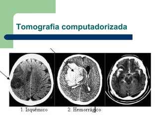 Tomografia computadorizada
 