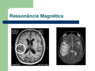 Ressonância Magnética
 
