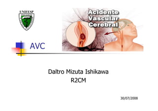 AVC


      Daltro Mizuta Ishikawa
              R2CM

                               30/07/2008
 