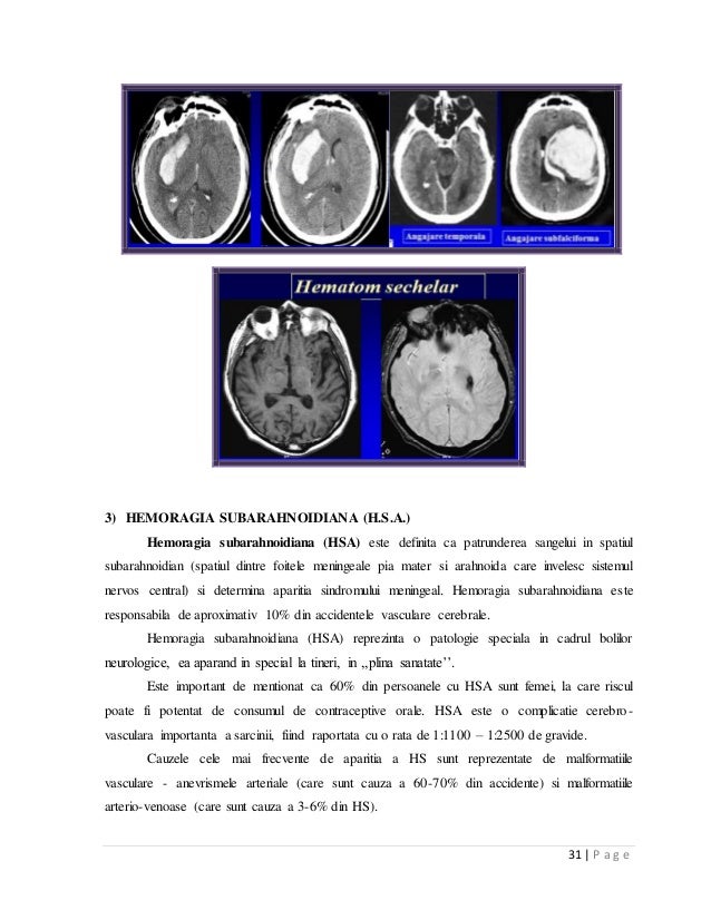 Avc vs xavc s format polrebull