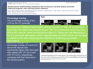Percentage overlap
The percentage overlap of the
CCA by the IJV gradually
increased as the head was
rotated to the left, at both 2 and 4  
cm above the clavicle. In the
neutral position, the mean
percentage overlap of the CCA by
the IJV was 23.6% at 2cm above 
the clavicle and 30.2% at 4cm 
above the clavicle. The
percentage overlap at 2 and 4 cm  
above the clavicle was
significantly higher when the head
was rotated ≥45° (P<0.01) and   
≥30° (P<0.01), respectively,   
compared with that observed in
the neutral position.
In conclusion, leftward head rotation should be kept to <45° for procedures
occurring 2cm above the clavicle and to <30° for procedures occurring 4cm   
above the clavicle, when puncturing the right IJV. Moreover, the flattening of
the IJV gradually decreases (until it approximates a perfect circle) as the head
is rotated to the side, improving the chances of achieving successful
cannulation.
 
