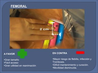 FEMORAL
A FAVOR
•Gran tamaño
•Fácil acceso
•Gran utilidad en reanimación
EN CONTRA
•Mayor riesgo de flebitis, infección y
Trombosis.
•Difícil mantenimiento y curación.
•Movilidad disminuída.
 