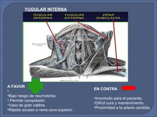 YUGULAR INTERNA
A FAVOR
•
•Bajo riesgo de neumotórax.
• Permite compresión.
•Vaso de gran calibre.
•Rápido acceso a vena cava superior.
EN CONTRA
•Incomodo para el paciente.
•Difícil cura y mantenimiento.
•Proximidad a la arteria carótida.
 