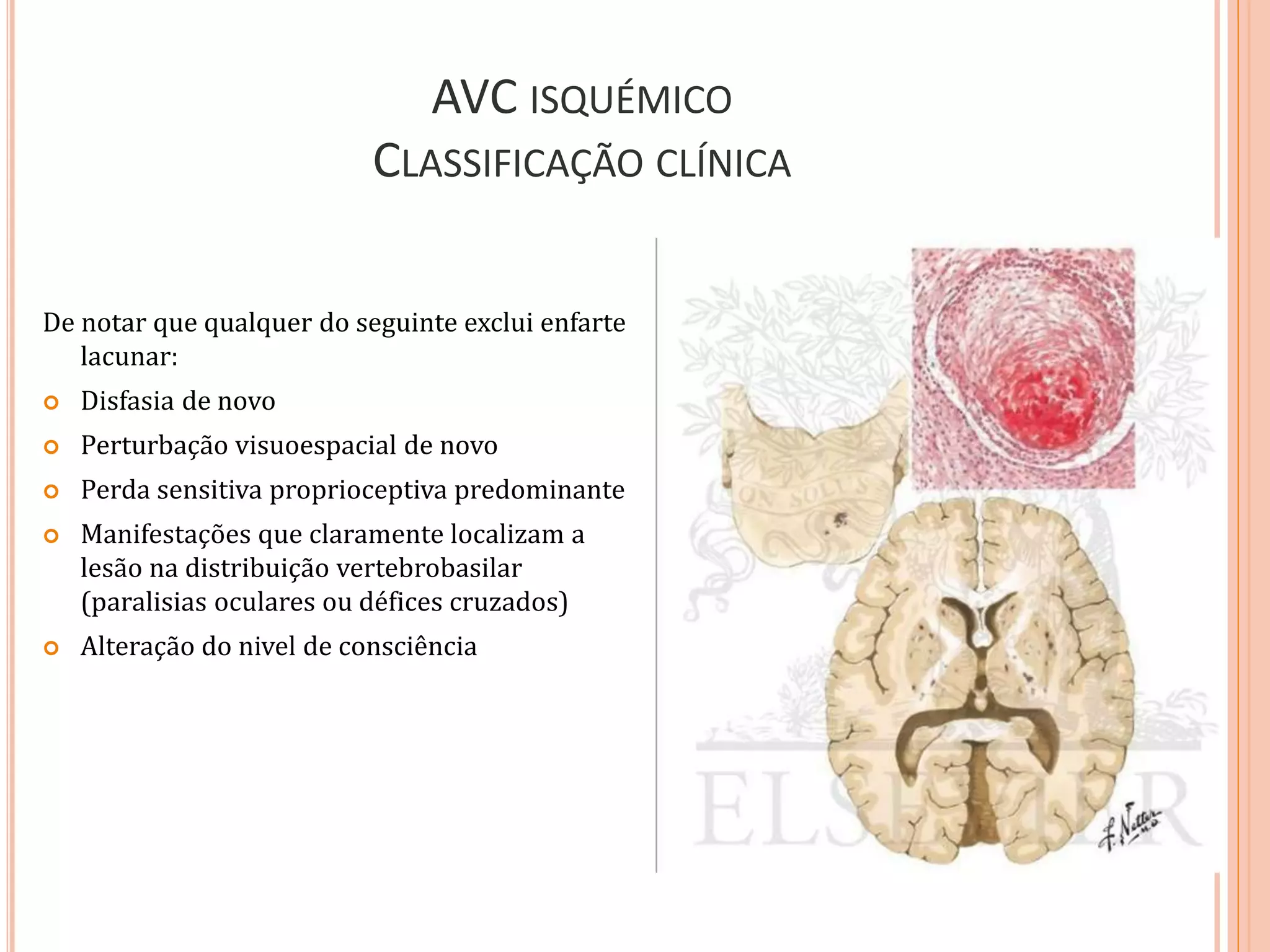 AVC ISQUÉMICO
CLASSIFICAÇÃO CLÍNICA
De notar que qualquer do seguinte exclui enfarte
lacunar:
 Disfasia de novo
 Perturbação visuoespacial de novo
 Perda sensitiva proprioceptiva predominante
 Manifestações que claramente localizam a
lesão na distribuição vertebrobasilar
(paralisias oculares ou défices cruzados)
 Alteração do nivel de consciência
 