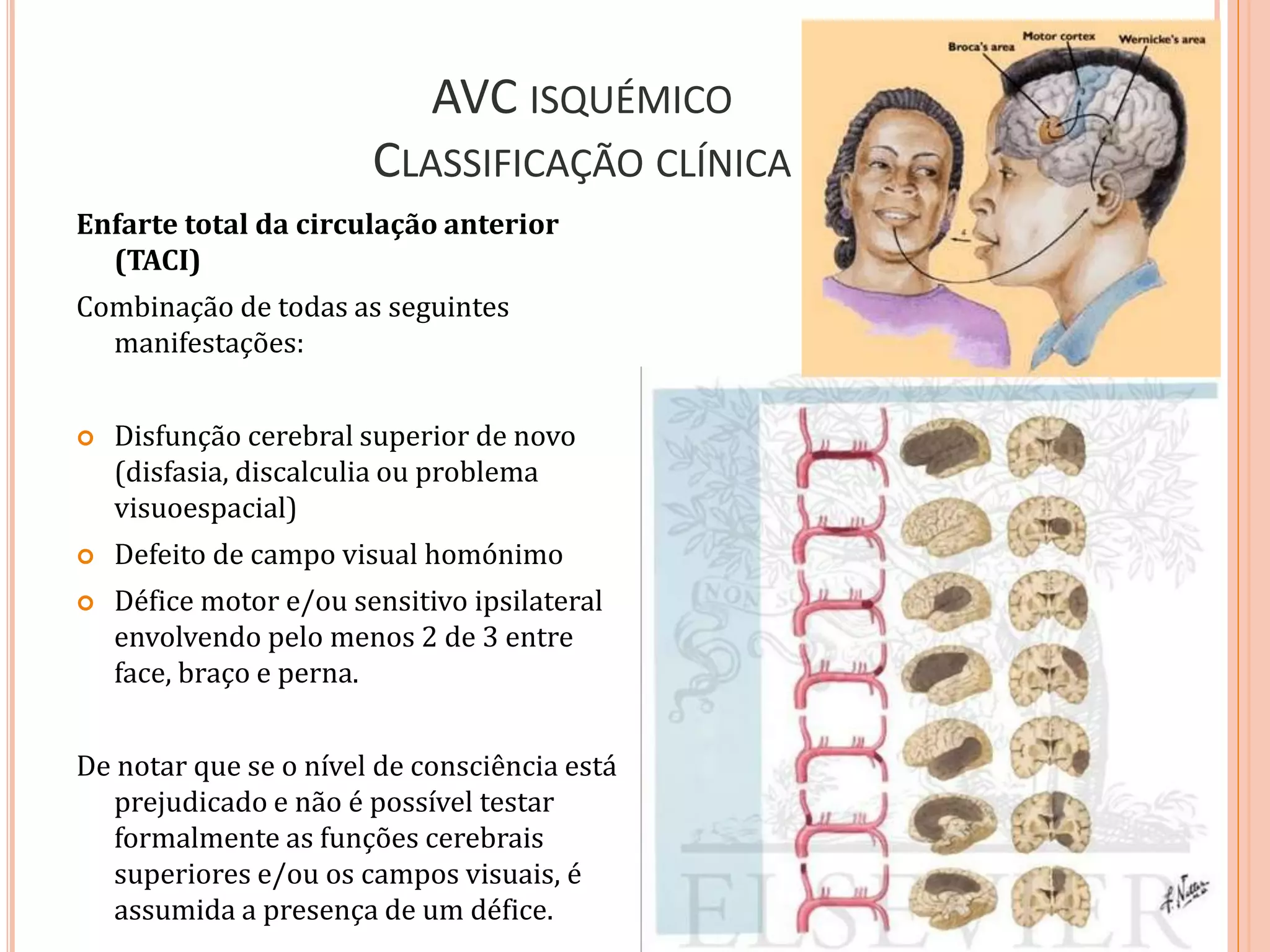 AVC ISQUÉMICO
CLASSIFICAÇÃO CLÍNICA
Enfarte total da circulação anterior
(TACI)
Combinação de todas as seguintes
manifestações:
 Disfunção cerebral superior de novo
(disfasia, discalculia ou problema
visuoespacial)
 Defeito de campo visual homónimo
 Défice motor e/ou sensitivo ipsilateral
envolvendo pelo menos 2 de 3 entre
face, braço e perna.
De notar que se o nível de consciência está
prejudicado e não é possível testar
formalmente as funções cerebrais
superiores e/ou os campos visuais, é
assumida a presença de um défice.
 
