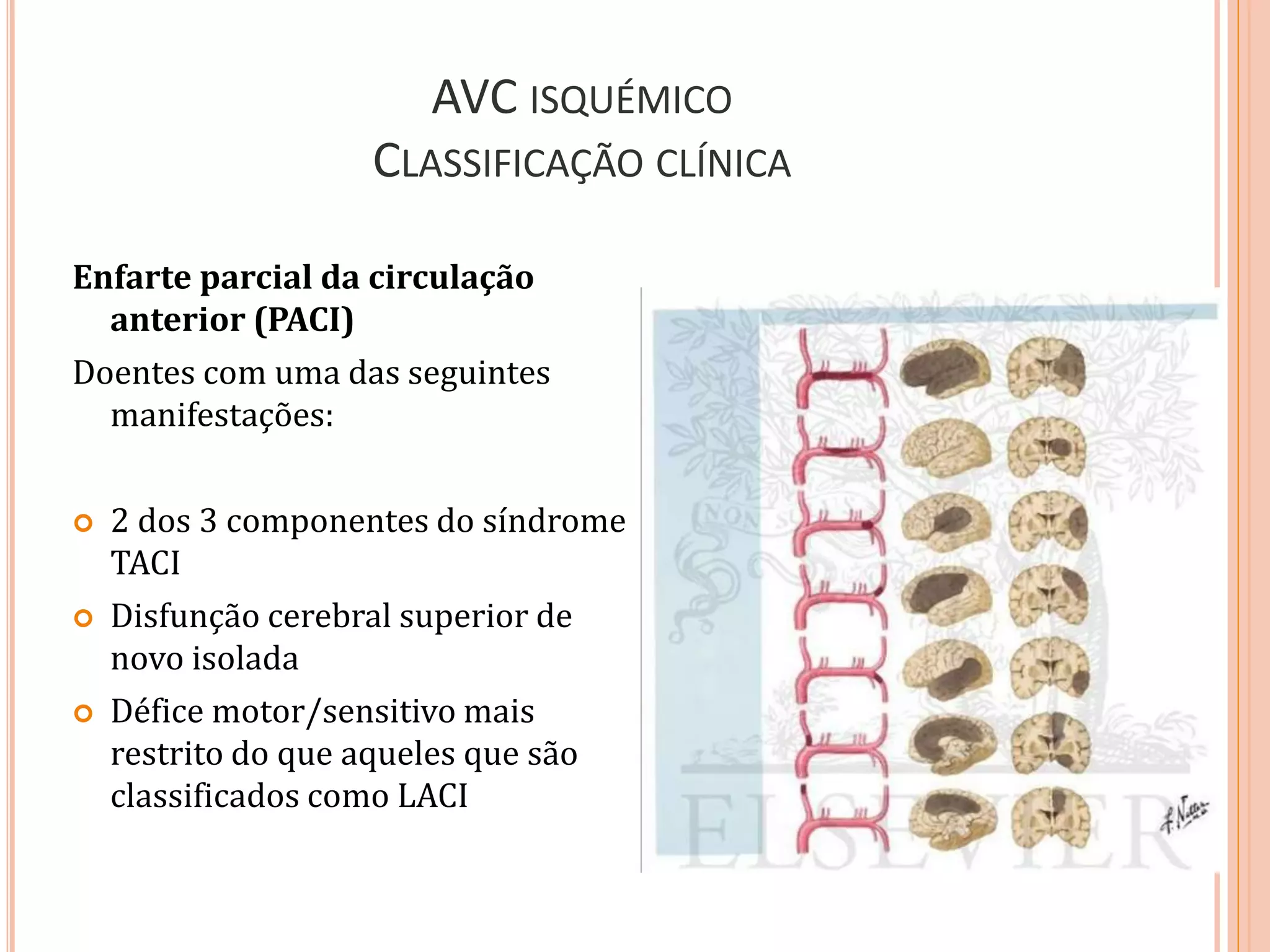 AVC ISQUÉMICO
CLASSIFICAÇÃO CLÍNICA
Enfarte parcial da circulação
anterior (PACI)
Doentes com uma das seguintes
manifestações:
 2 dos 3 componentes do síndrome
TACI
 Disfunção cerebral superior de
novo isolada
 Défice motor/sensitivo mais
restrito do que aqueles que são
classificados como LACI
 