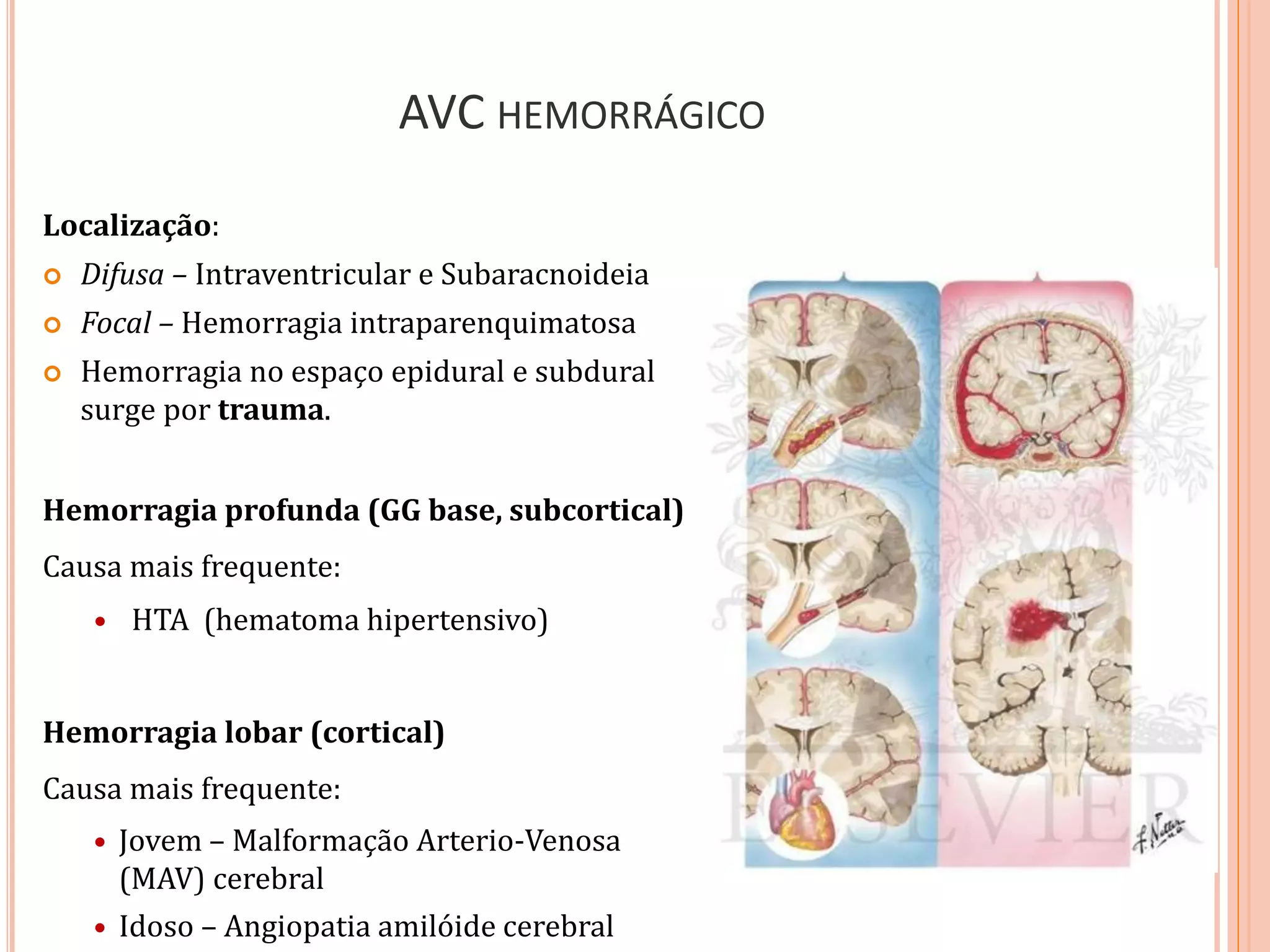 AVC HEMORRÁGICO
Localização:
 Difusa – Intraventricular e Subaracnoideia
 Focal – Hemorragia intraparenquimatosa
 Hemorragia no espaço epidural e subdural
surge por trauma.
Hemorragia profunda (GG base, subcortical)
Causa mais frequente:
 HTA (hematoma hipertensivo)
Hemorragia lobar (cortical)
Causa mais frequente:
 Jovem – Malformação Arterio-Venosa
(MAV) cerebral
 Idoso – Angiopatia amilóide cerebral
 