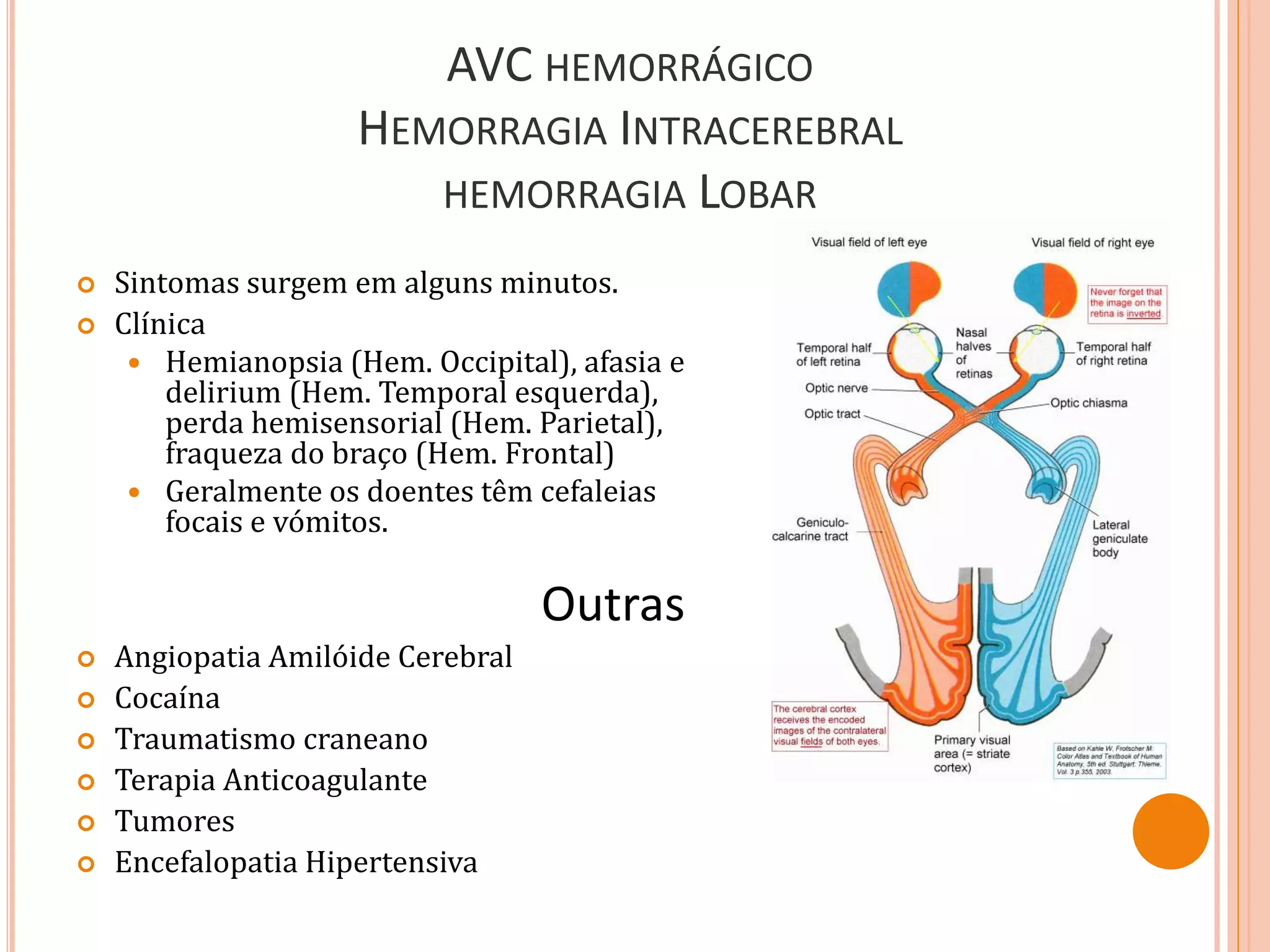  Sintomas surgem em alguns minutos.
 Clínica
 Hemianopsia (Hem. Occipital), afasia e
delirium (Hem. Temporal esquerda),
perda hemisensorial (Hem. Parietal),
fraqueza do braço (Hem. Frontal)
 Geralmente os doentes têm cefaleias
focais e vómitos.
Outras
 Angiopatia Amilóide Cerebral
 Cocaína
 Traumatismo craneano
 Terapia Anticoagulante
 Tumores
 Encefalopatia Hipertensiva
AVC HEMORRÁGICO
HEMORRAGIA INTRACEREBRAL
HEMORRAGIA LOBAR
 