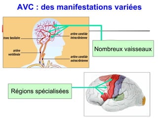 AVC : des manifestations variées




                       Nombreux vaisseaux




Régions spécialisées
 