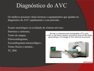 Diagnóstico do AVC
    Os médicos possuem várias técnicas e equipamentos que ajudam no
    diagnóstico de AVC rapidamente e com precisão.

   Exame neurológico ou avaliação do sistema nervoso;
   Sintomas e sintomas;
   Testes de sangue,
   Eletrocardiograma,
   Ecocardiograma transesofágico ;
   Testes físicos e mentais ;
   TC, RM.
 