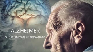 ALZHEIMER
CAUSAS ,SINTOMAS E TRATAMENTO
 