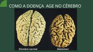 COMO A DOENÇA AGE NO CÉREBRO
 