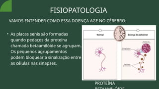 FISIOPATOLOGIA
VAMOS ENTENDER COMO ESSA DOENÇA AGE NO CÉREBRO:
• As placas senis são formadas
quando pedaços da proteína
chamada betaamilóide se agrupam.
Os pequenos agrupamentos
podem bloquear a sinalização entre
as células nas sinapses.
PROTEÍNA
 