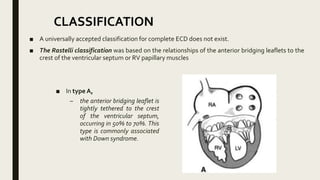 Av canal defect | PPTX