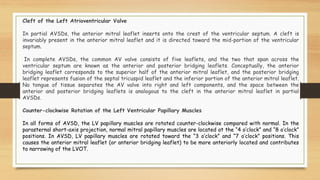 A v canal defect may 2021 | PDF
