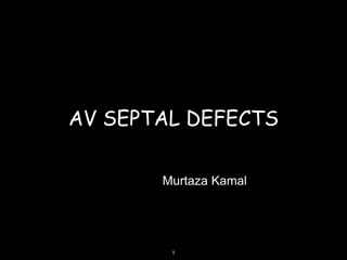 AV SEPTAL DEFECTS
Murtaza Kamal
1
 