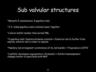 Sub valvular structures
•Beneath 5 commissures: 5 papillary msls
•2 lt. Sided papillary msls oriented closer together
•Lateral leaflet smaller than normal PML
•2 papillary msls: Counterclockwise rotated—> Posterior msl is further from
septum, anterior msl is closer to septum
•Papillary msl arrangment+ prominence of AL msl bundle—> Progressive LVOTO
•Leaflets: Developes regurgitation, thickened—> Exhibit haemodynamic
changes similar to associated with MVP
56
 